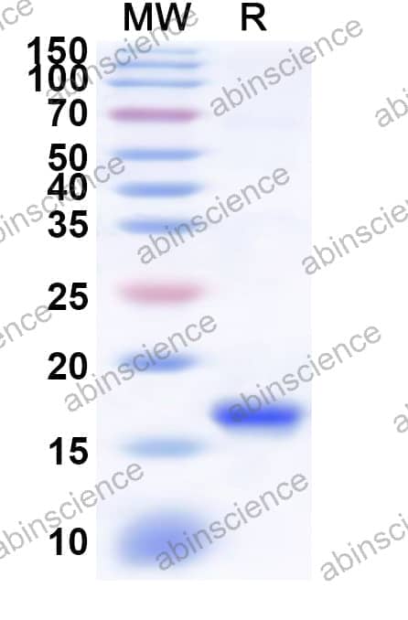 Human KLRC3 Recombinant Protein (N-His)