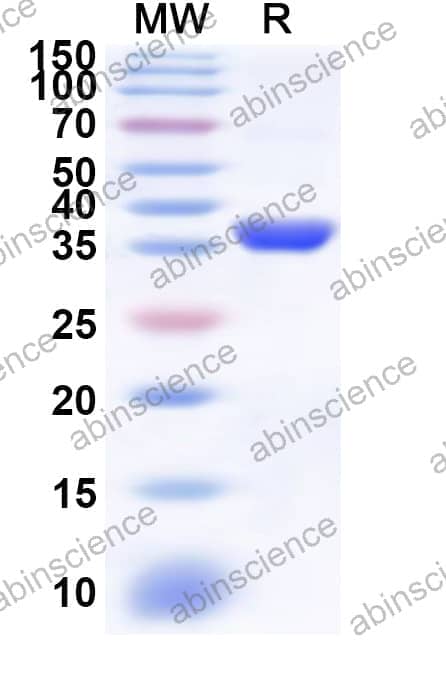 Human CRYZ Recombinant Protein (N-His)
