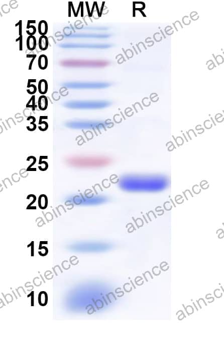 Human RING1 Recombinant Protein (N-His)