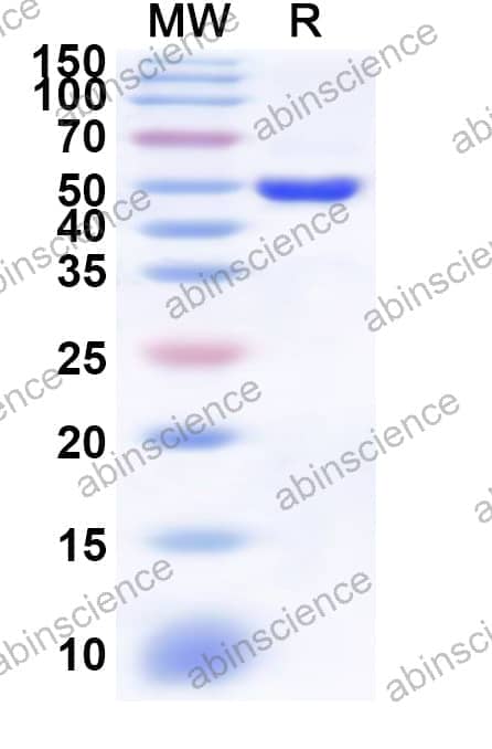 Human PMPCA Recombinant Protein (N-His)