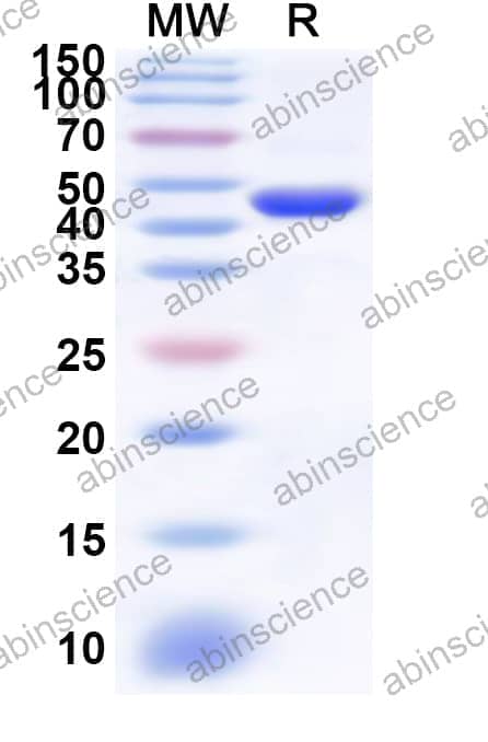 Human GALNT2 Recombinant Protein (N-His)