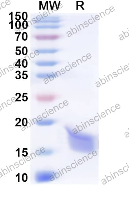 Human LAMTOR4 Recombinant Protein (N-His)