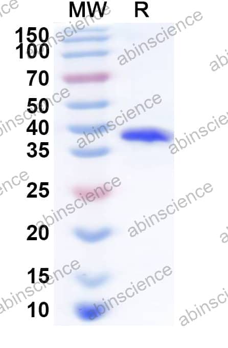 Human ZNF460 Recombinant Protein (N-His)