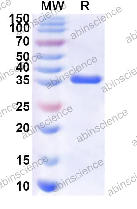 Human ST3GAL3 Recombinant Protein (N-His)