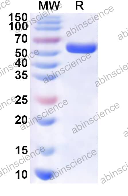 Human SF3A3 Recombinant Protein (N-His)
