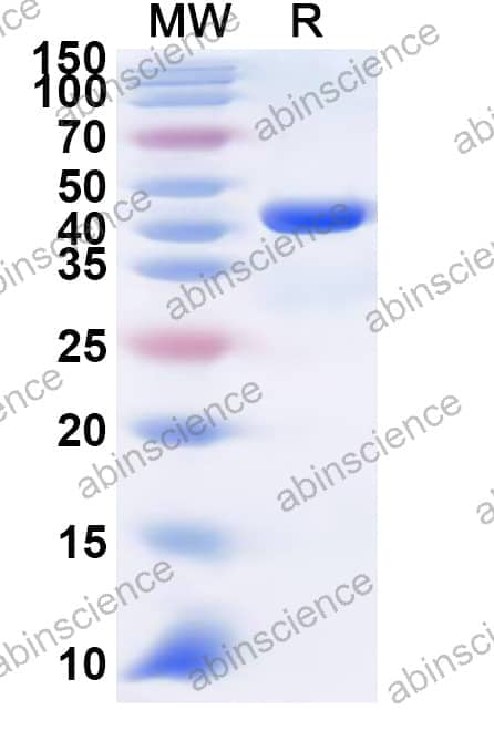 Human CLPSL1 Recombinant Protein (N-GST & C-His)