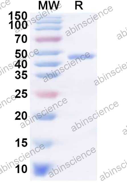 Human SMYD5 Recombinant Protein (N-His)