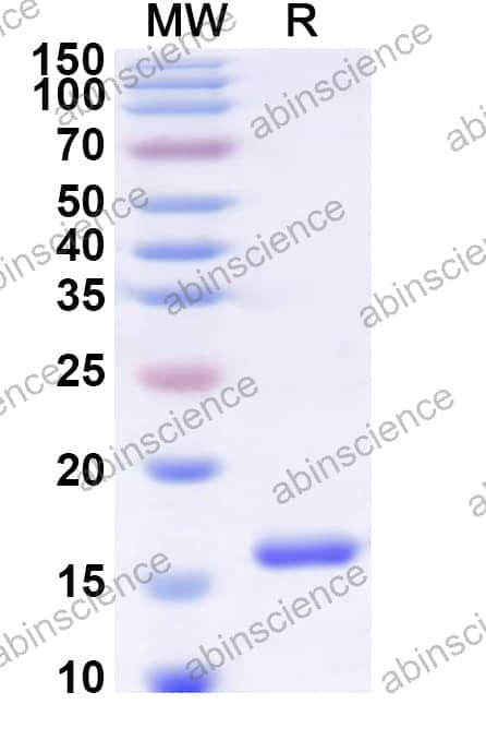 Human ZFYVE16 Recombinant Protein (N-His)