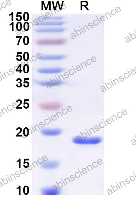 Human SEC24A Recombinant Protein (N-His)