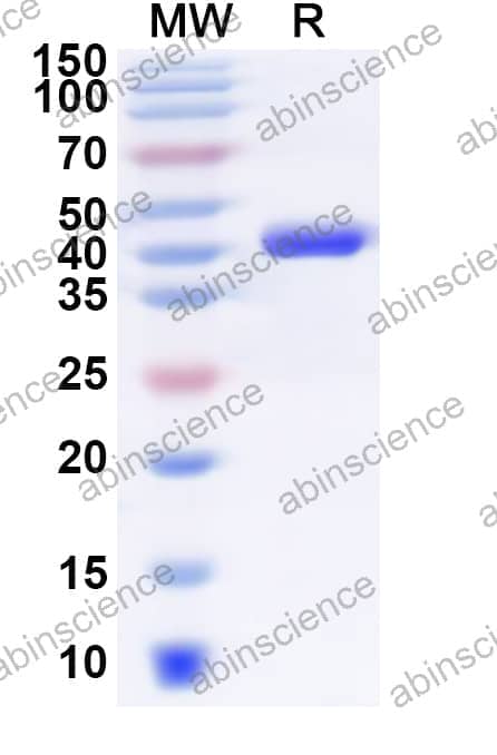 Human PTER Recombinant Protein (N-His)