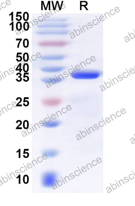 Human RANGAP1 Recombinant Protein (N-His)