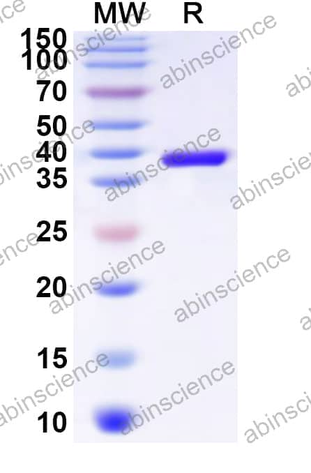 Human YAF2 Recombinant Protein (N-His-KSI)
