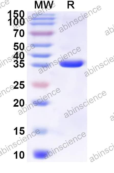 Human CD3G Recombinant Protein (N-GST & C-His)