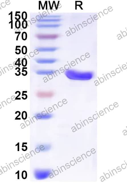 Human SLC16A4 Recombinant Protein (N-His-KSI)
