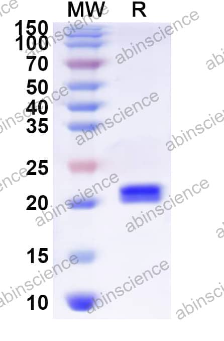 Human COLEC12 Recombinant Protein (N-His)
