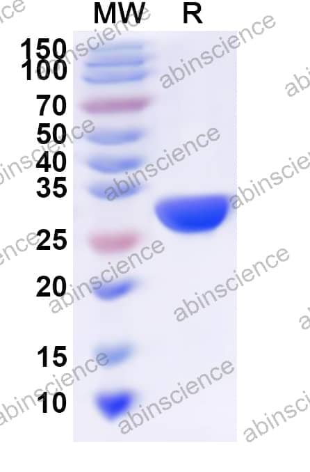 Human SPR Recombinant Protein (N-His)