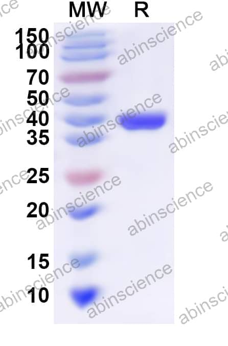 Human GCC1 Recombinant Protein (N-His)