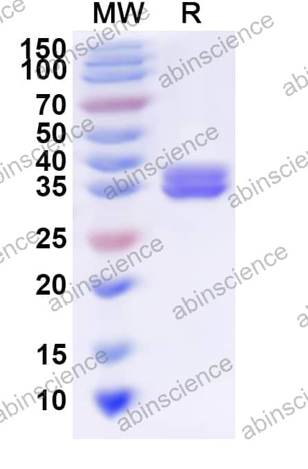 Human TMEM108 Recombinant Protein (N-His-KSI)