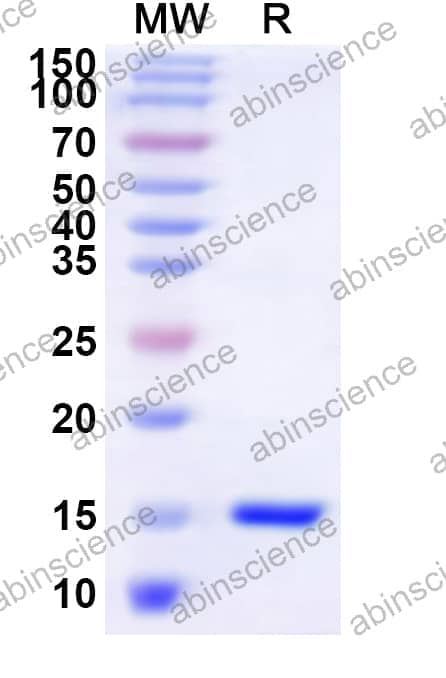 Human DAZAP2 Recombinant Protein (N-His)