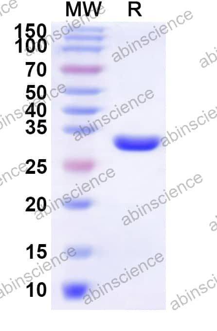 Human LBH Recombinant Protein (N-His-KSI)