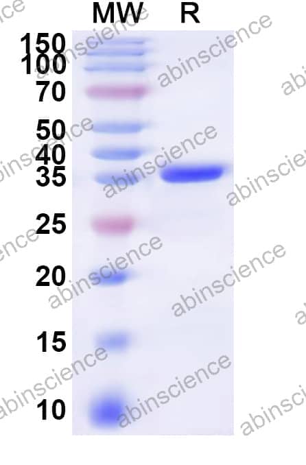 Human ODF1 Recombinant Protein (N-GST & C-His)
