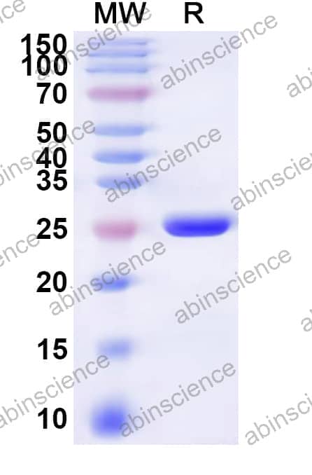 Human SLC13A3 Recombinant Protein (N-His-KSI)