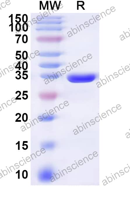 Human FAIM2 Recombinant Protein (N-His-KSI)