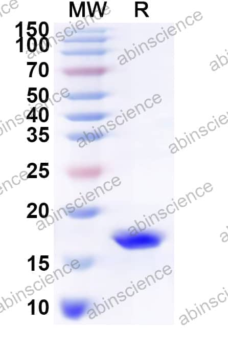 Human C1D Recombinant Protein (N-His)