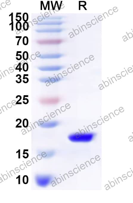 Human SNX8 Recombinant Protein (N-His)