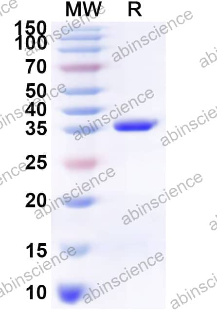 Human NEXMIF Recombinant Protein (N-His-KSI)