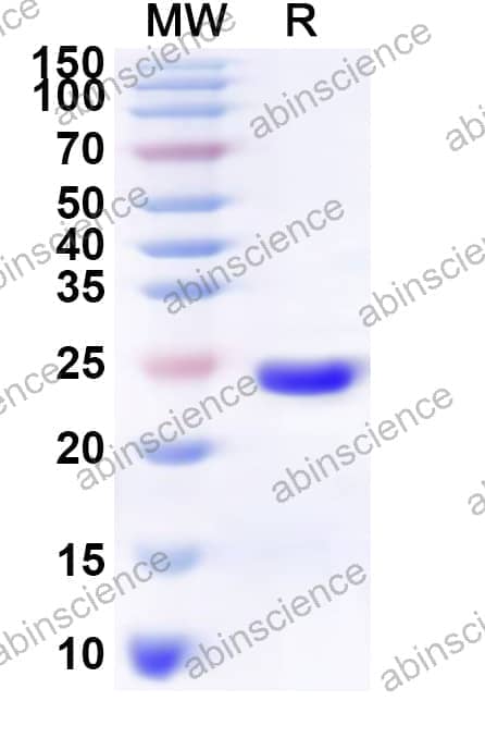 Human MS4A2 Recombinant Protein (N-His-KSI)