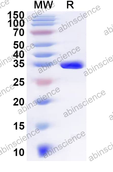 Human UBXN2B Recombinant Protein (N-GST & C-His)