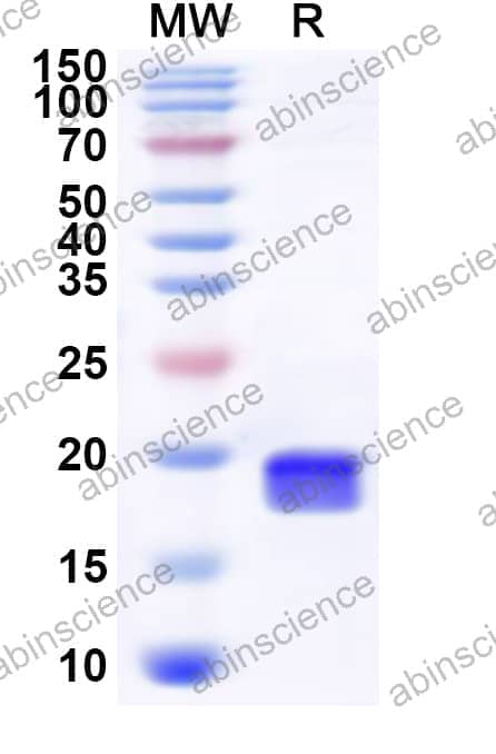 Human RBM25 Recombinant Protein (N-His)