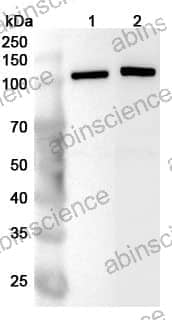 Anti-RBM25 Polyclonal Antibody