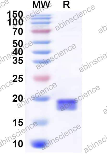 Human UBE2A Recombinant Protein (N-His)