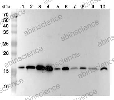 Anti-UBE2A Polyclonal Antibody