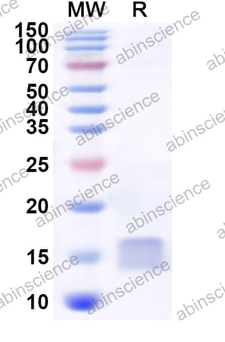 Human DYNLT3 Recombinant Protein (N-His)