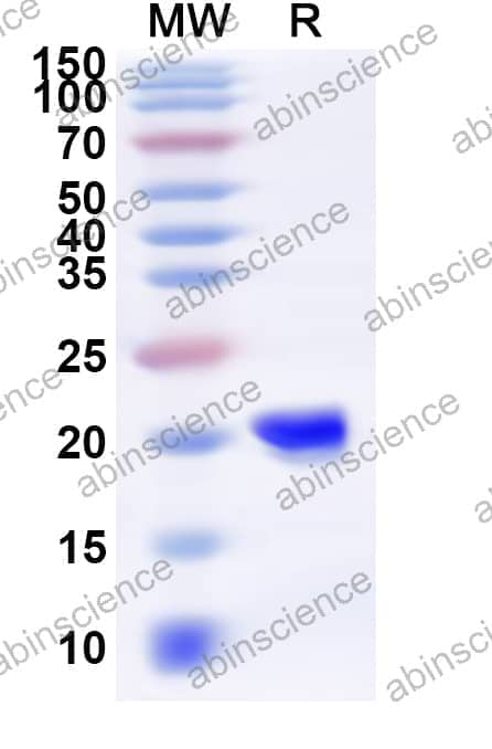 Human FHIT Recombinant Protein (N-His)
