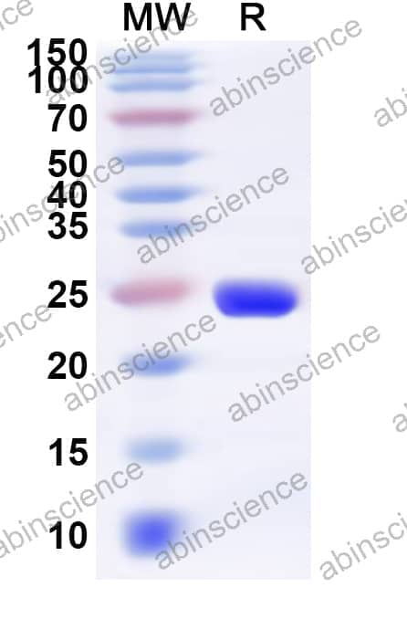 Human CHN2 Recombinant Protein (N-His)
