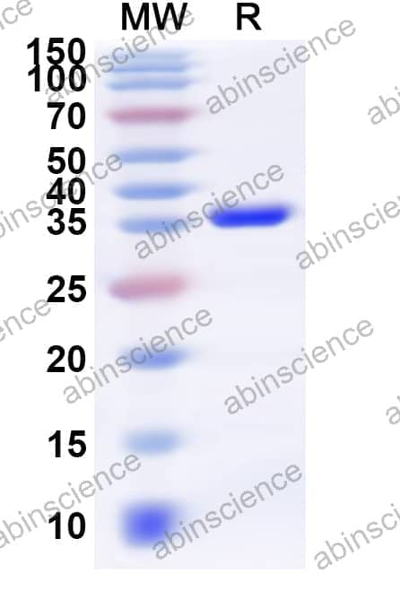 Human NAPA Recombinant Protein (N-His)
