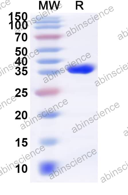 Human PDLIM3 Recombinant Protein (N-GST & C-His)