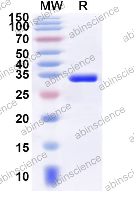 Human SAFB Recombinant Protein (N-GST & C-His)