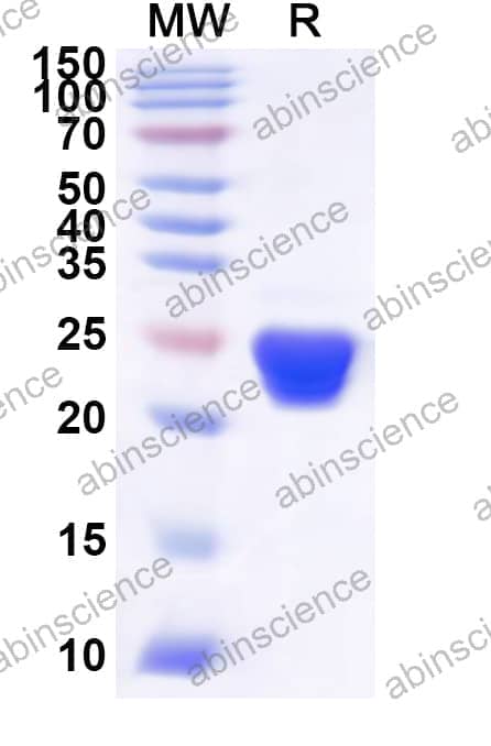 Human GRSF1 Recombinant Protein (N-His)
