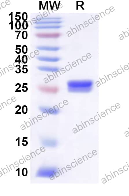 Human STARD3 Recombinant Protein (N-His)