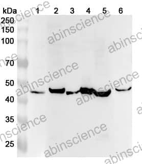 Anti-STARD3 Polyclonal Antibody