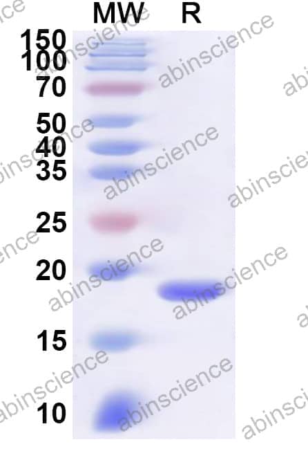 Human MED21 Recombinant Protein (N-His)