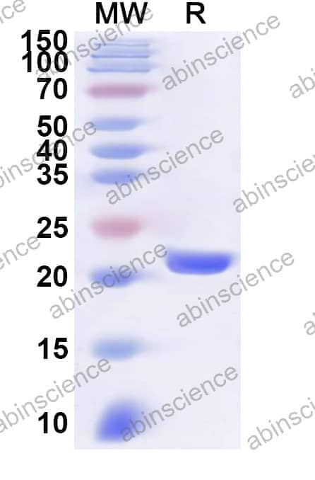Human MORF4L2 Recombinant Protein (N-His)