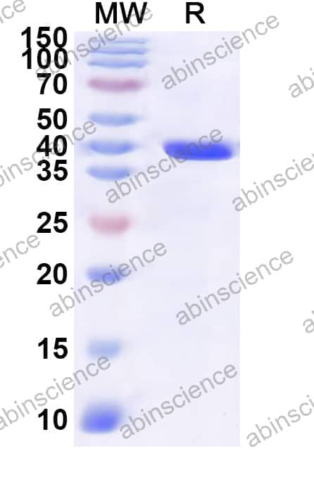 Human RNPS1 Recombinant Protein (N-GST & C-His)