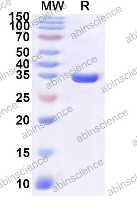 Human SULT2A1 Recombinant Protein (N-His)