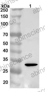 Anti-Human SULT2A1 Polyclonal Antibody